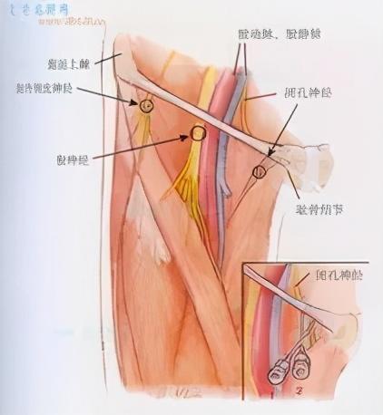 大腿外侧疼痛的几种原因