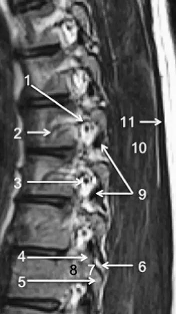 ռ׵ MRI ͼ