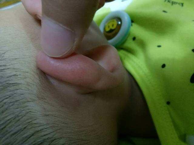 超级宝妈|为何新生儿耳朵上会有“小洞”？父母提前了解，避免再犯低级错误