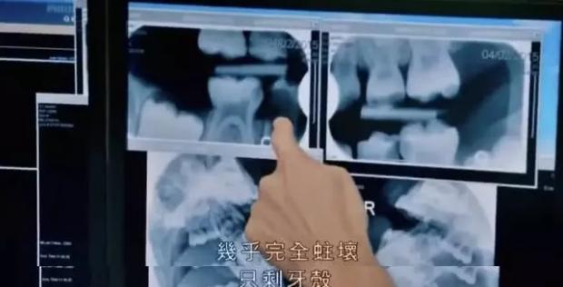 你的育儿经：孙俪教孩子刷牙获高赞，优秀的父母，从来不和孩子“讲道理”