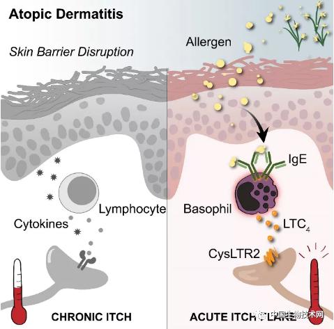 湿疹加重，急性瘙痒用抗组胺药无效？Cell揭示：这是完全不同的致“痒”机制