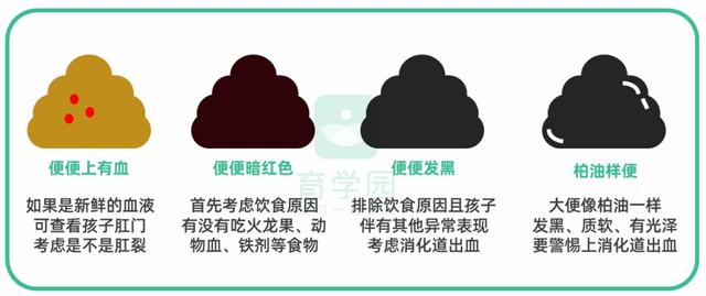 [你的育儿经]孩子身上出现这些颜色，是健康警报，却总被忽视