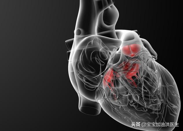 你的育儿经■#洪医生看出生缺陷#——胎儿心脏强光斑是异常吗？