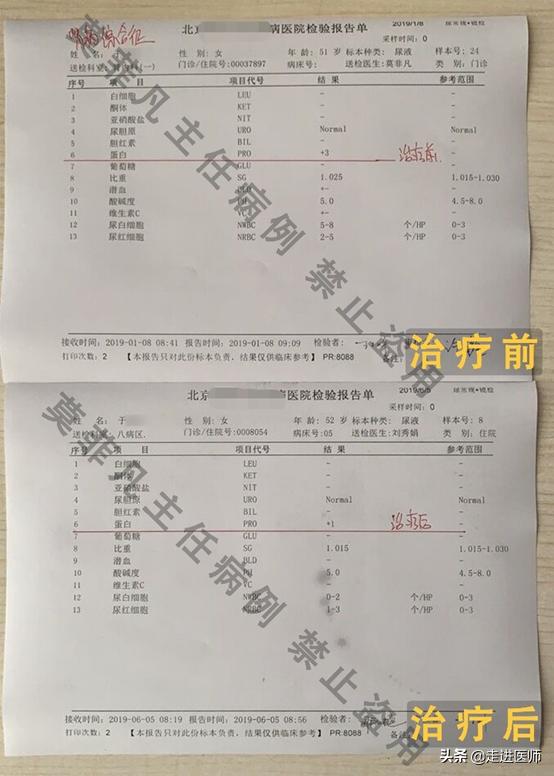 肾综患者如何增强体质，避免复发，中医给出切实可行5个办法