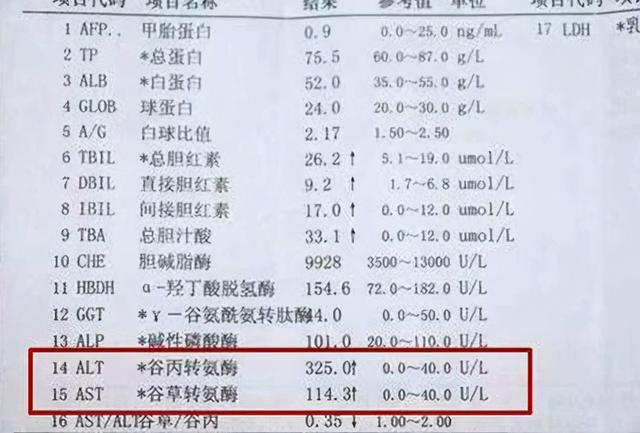 转氨酶过高，专家劝告：坚持2件事，转氨酶慢慢降，养肝更护肝