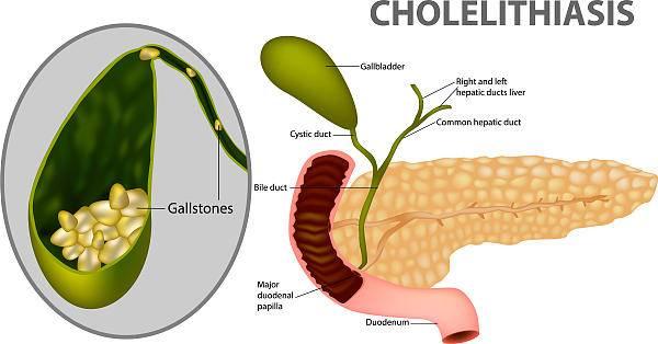 肝气|养肝护肝，中医教您分两步走