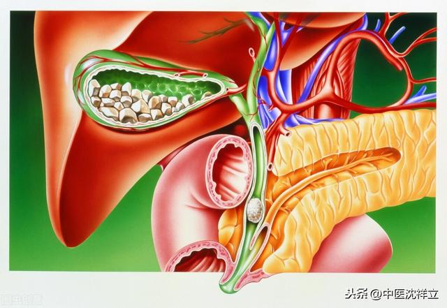 从患者那得来一张治胆囊结石秘方，初看不以为意，细思只有佩服