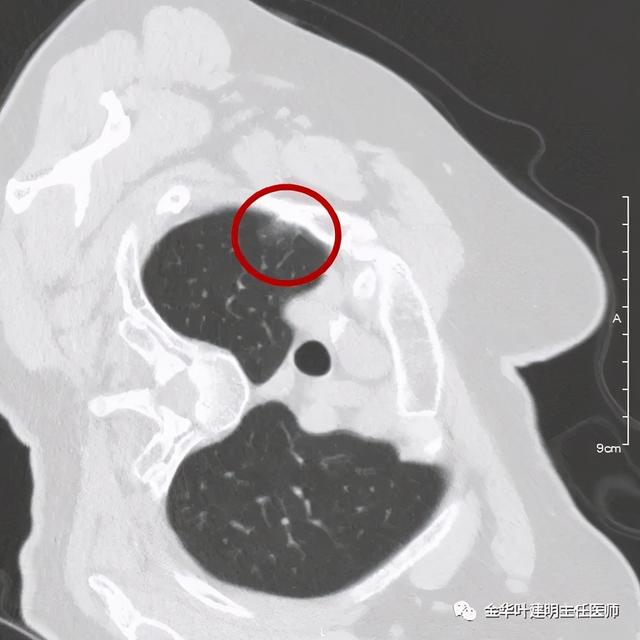 如此违反原则的手术方案设计，你支持吗？