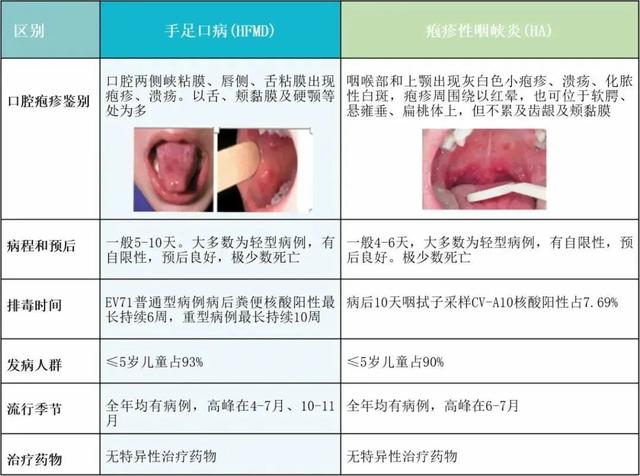 手足|传染性强！宁波疾控：正处流行高峰季！出现这些症状请立即就医…