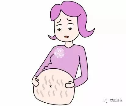 「你的育儿经」坚持抹橄榄油就能祛除妊娠纹？别逗了
