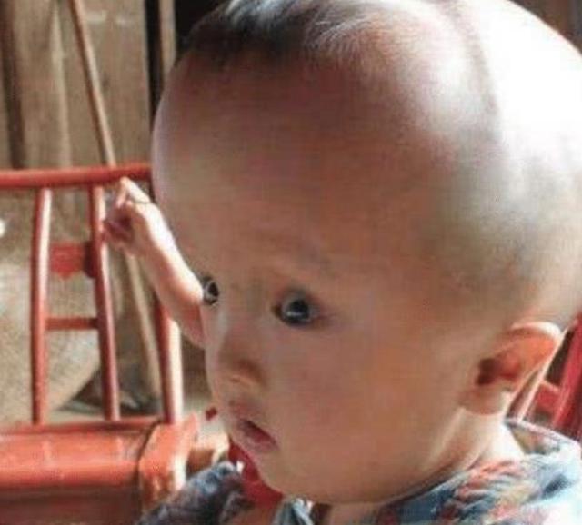 「超级宝妈」17年前喝“空壳奶粉”的大头娃娃，现在怎么样了？网友：不可原谅