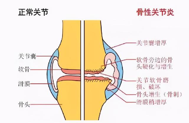 膝关节一活动，时不时传来“咔咔咔”的响声，需要治疗吗？