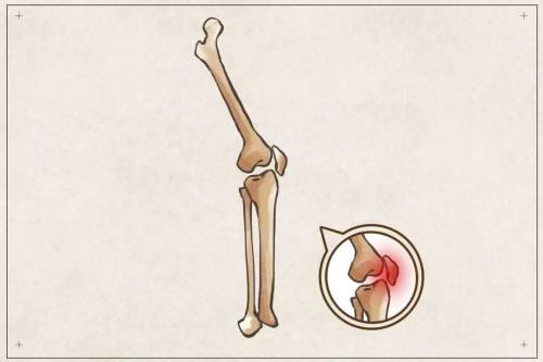 动静健康丨一到冬天膝盖就“发凉”？一招让你的膝关节暖起来