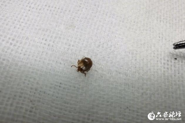 [你的育儿经]六安一8岁男孩头顶钻进一只蜱虫！现在正是高发季