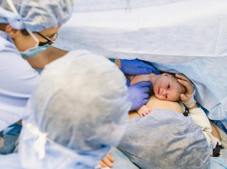 超级宝妈|为啥剖腹产后要先“去枕平卧”6小时，5点剖腹产术后常识要了解