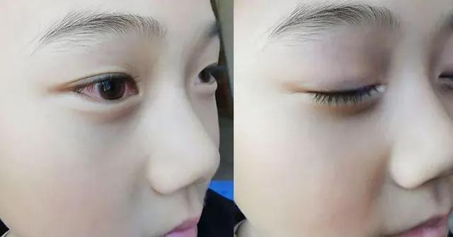 21世纪经济报道@这件事情不重视，孩子的眼睛都毁了