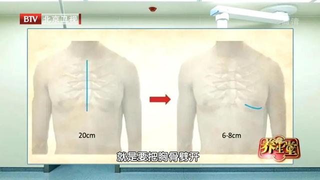 支架都救不了的心脏！专家：熬夜是高危因素，别等血管变硬才后悔