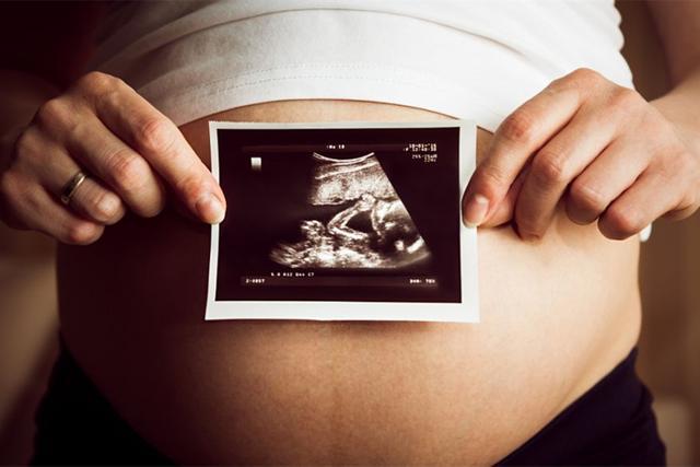 「超级宝妈」孕妇最重要的产检“大排畸”，什么时间去最好？孕妈可别弄错了