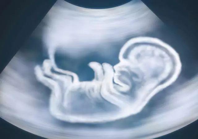 【你的育儿经】90后产妇孕出“带壳”萌娃，丈夫看后不敢要，医生却说“恭喜了”