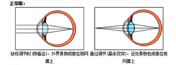 近视|科学汇 | 视力保健很重要，但你真的了解眼睛吗，为啥学生更容易近视