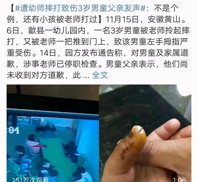 3岁男孩在幼儿园被打骨折，老师拒绝道歉，宝爸只好“以牙还牙”