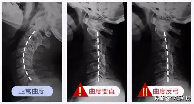 半个手机重，触控遥控操作，智能语音提示续航长Type-c接口