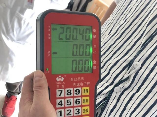 手术|胃是普通人的3倍大？青浦428斤壮汉不得已做手术切除三分之二胃脏