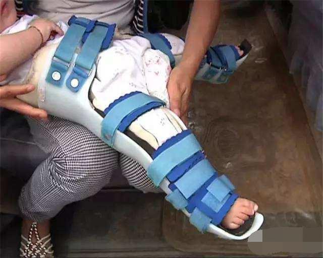 奋斗吧小青年|熊孩子偷摘邻居家桃子，却不小心摔断腿，邻居无辜躺枪遭索赔