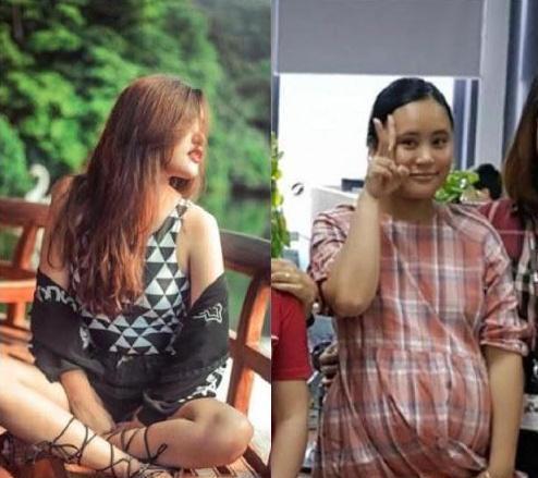 超级宝妈▲生娃有多“伤身”？看完这位双胞胎妈妈生娃前后对比照，直喊可怕