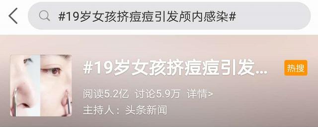 痘痘|警惕！挤了颗痘痘，瘫痪了