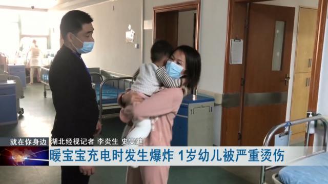 充电时爆炸，致一岁幼儿严重烫伤，这种产品很多人都用过