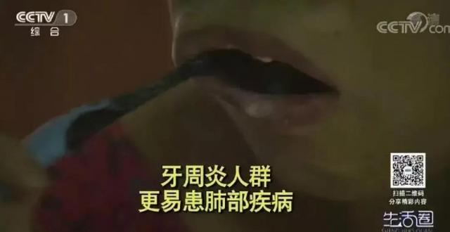 肺部|长期不刷牙会引发肺炎？没错！这类人群的感染率还会大大增加