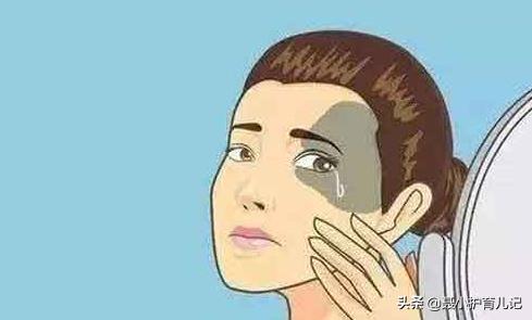 你的育儿经|新生儿屁股淤青怎么回事？如果属于这三种“胎记”记得看医生