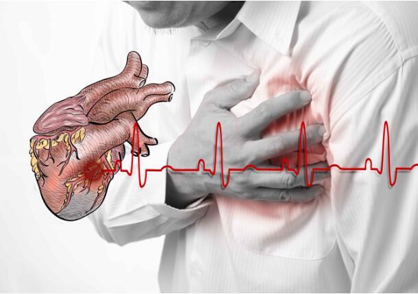 心梗越来越年轻化，有这4种情况的人，易诱发心梗，你是否在其中