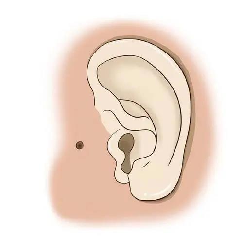 感染|长了“聪明洞”，真的会聪明吗？