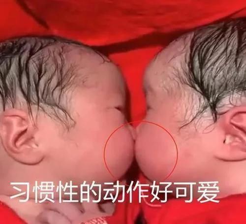 超级宝妈|好有爱！龙凤胎出生才20分钟，妹妹就“夺走”哥哥的初吻