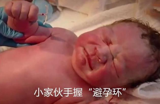 [超级宝妈]“暴躁宝宝”走红，一出生就瞪着医生，网友配的台词亮了