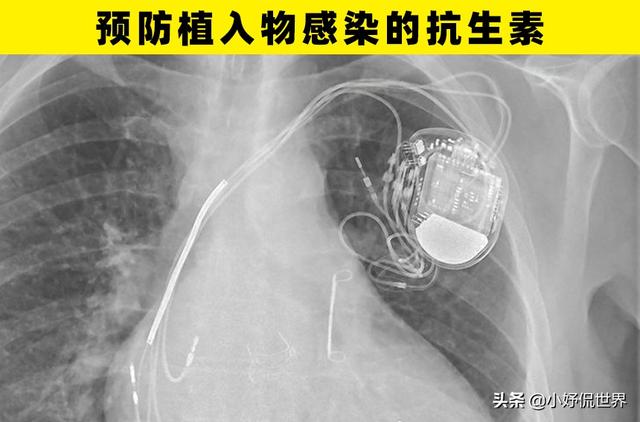 可以为人类健康带来帮助的6个科学技术进步