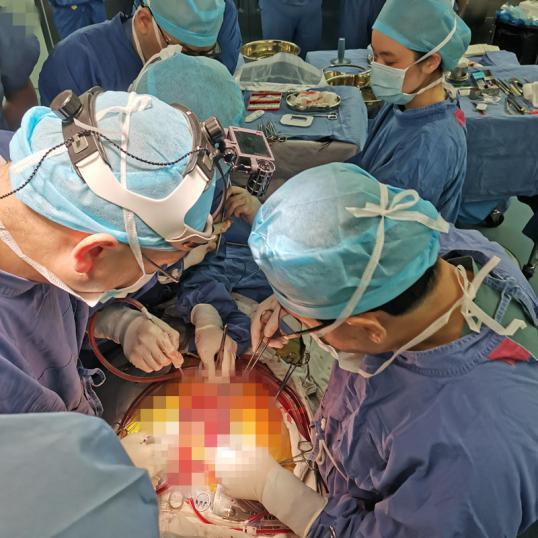 “人工心脏”不再科幻——复旦大学附属中山医院完成华东地区首例全国产心室辅助装置植入