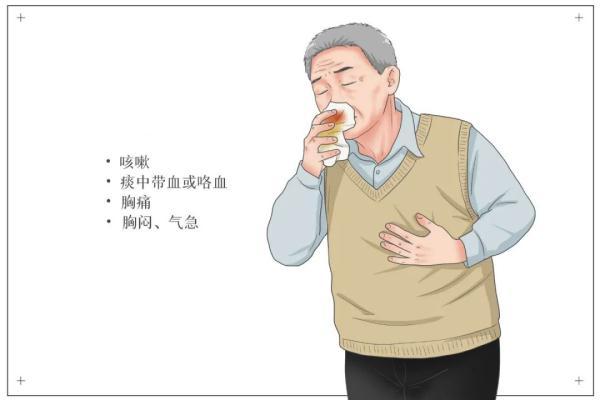 肿瘤|癌症到来的这几个预警信号，千万要注意