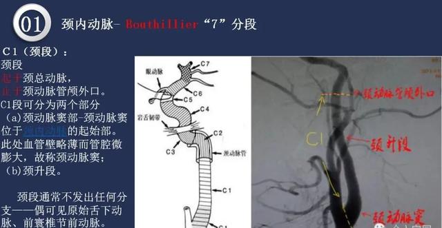 头颈动脉系统相关解剖