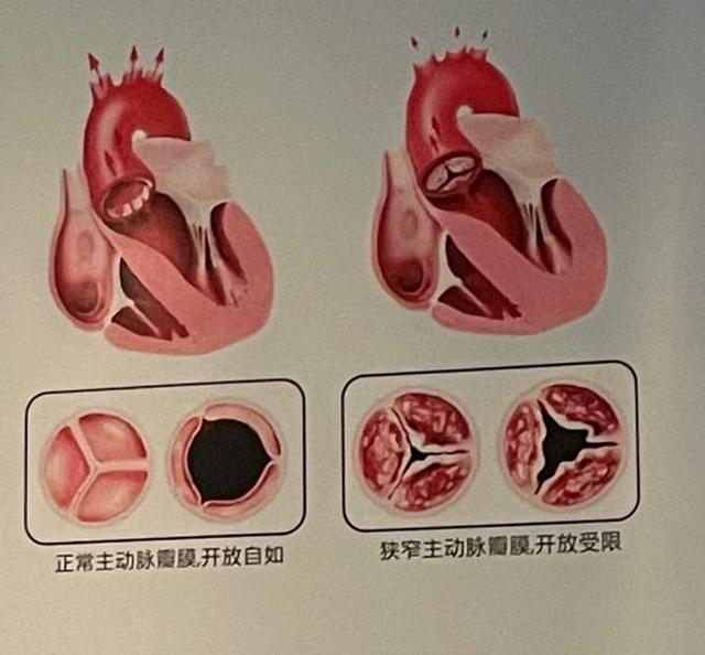 老太太|一个月昏厥两三次！老太太停了旅游、不敢出门，就怕随时随地突然倒下