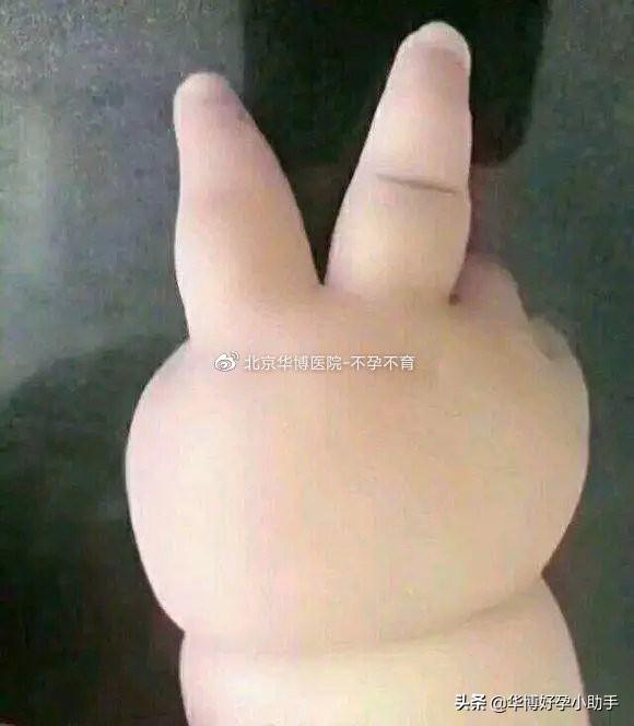 梦的色彩|据说肉肉多，生孩子不能打无痛？