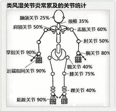 抗O、类风湿因子、C反应蛋白、抗CCP抗体-风湿指标意义解析