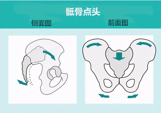 女性产后大腿根部缝隙大？莫忽视骶骨后翻！三个动作帮你收骨盆