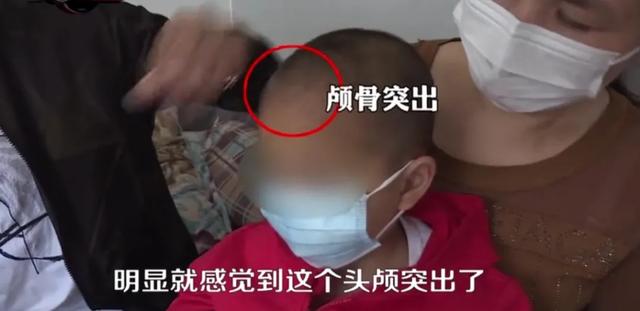 [你的育儿经]痛心！多名幼儿变“大头娃娃”，都跟喝了这种“奶粉”有关