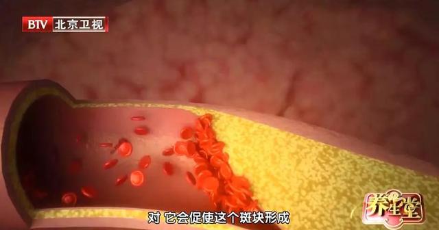 预示脑中风12大症状！两个以上可得要小心，警惕中风找上门