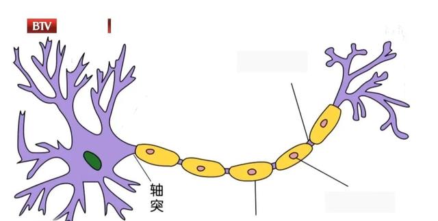 这种病痛起来生不如死！专家带来新技术，不用开刀，“一针止痛”