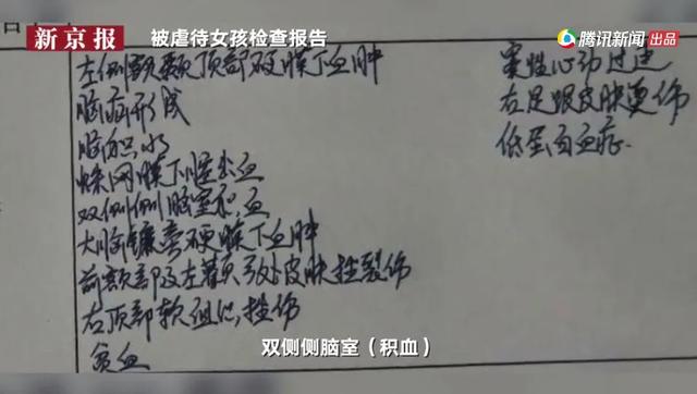 优雅的叶子■4岁女童被“网红”后妈虐待濒死：有些人，真的不配当父母