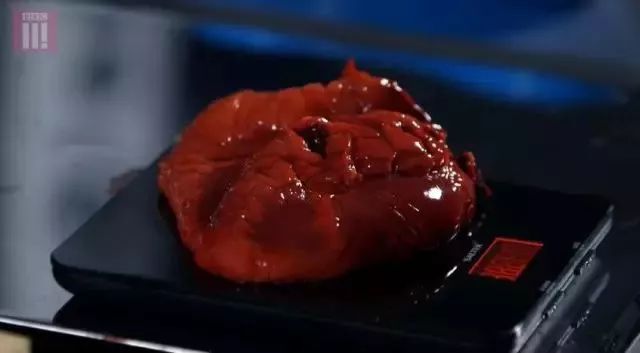 体重|一半国人超重！看完胖子的解剖内脏，只想减肥！